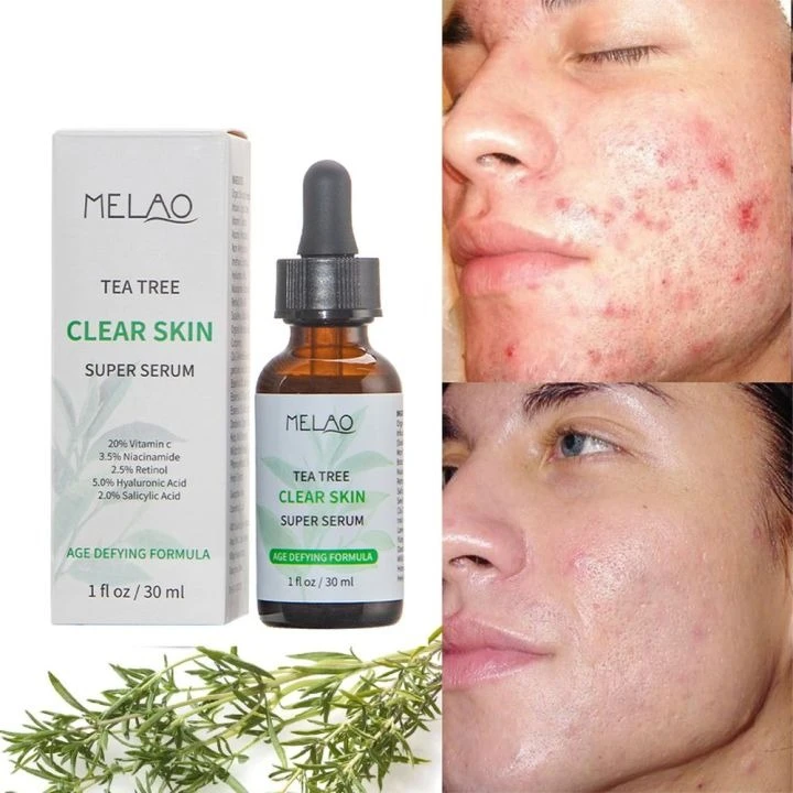 MELAO TEA TREE CLEAR SKIN SUPER SERUM-30ML