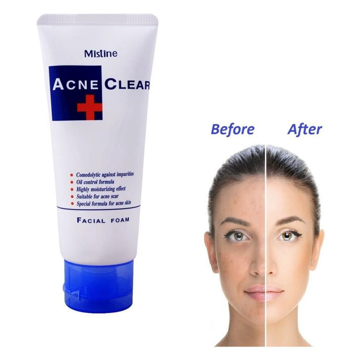 Mistine Acne Clear Facial Foam-100 ml