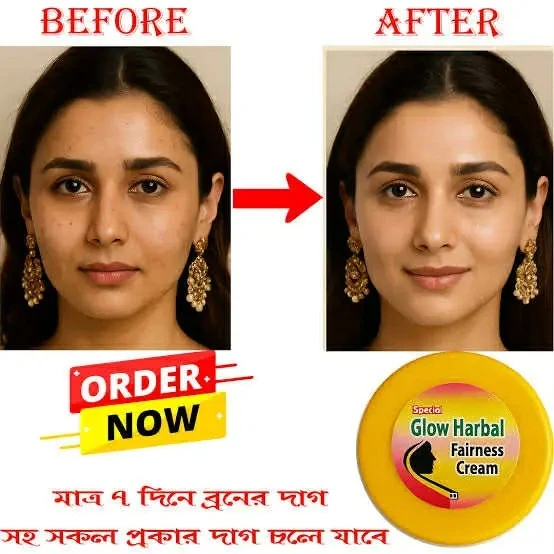 Glow Herbal Fairness cream